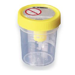 CONTENITORE URINA STERILE MEDIPRESTERIL CON SISTEMA TRANSFERT PER PROVETTE SOTTOVUOTO - Dolomiti e Natura